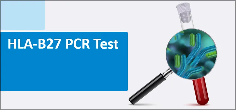 What is HLA-B27 PCR Test: Uses, Procedure, Precautions & Test Price